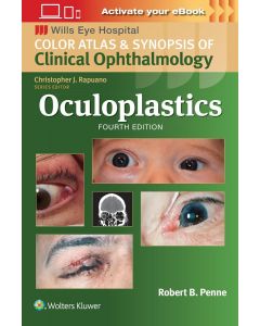 Oculoplastics 4th edition