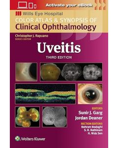 Color Atlas and Synopsis of Clinical Ophthalmology Uveitis