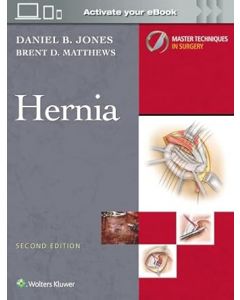 Master Techniques in Surgery: Hernia: Print + eBook with Multimedia