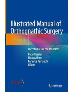 Illustrated Manual of Orthognathic Surgery: Osteotomies of the Mandible