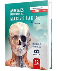 Abordajes Quirúrgicos del Macizo Facial 3 edicion