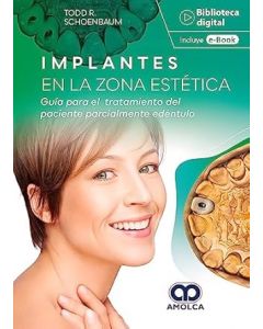 Implantes en la Zona Estética. Guía para el Tratamiento del Paciente Parcialmente Edéntulo