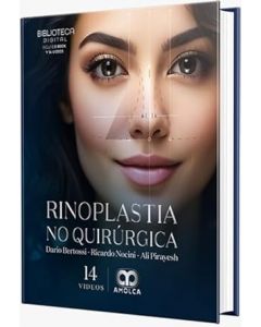 Rinoplastia No Quirúrgica