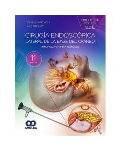 Cirugía Endoscópica Lateral de la Base del Cráneo. Principios, Anatomía y Abordajes