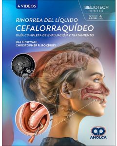 Rinorrea del Líquido Cefalorraquídeo. Guía Completa de Evaluación y Tratamiento