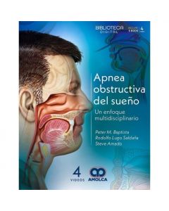 Apnea Obstructiva del Sueño. Un Enfoque Multidisciplinario