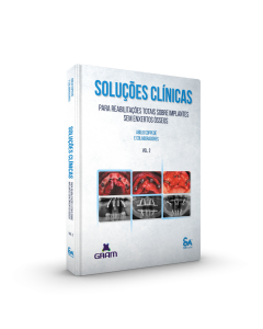 Soluções Clínicas Para Reabilitações Totais Sobre Implantes Sem Enxertos Ósseos - Vol. 2