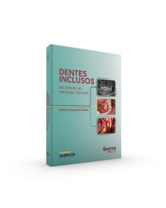 Dentes Inclusos: um desafio ao cirurgião-dentista