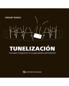 TUNELIZACIÓN. Concepto integral en la cirugía plástica periodontal