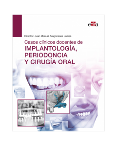 Casos Clínicos Docentes de Implantología, Periodoncia y Cirugía Oral