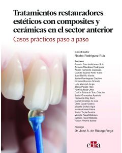 Tratamientos Restauradores Estéticos con Composites y Cerámicas en el Sector Anterior