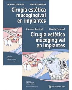 Cirugía Estética Mucogingival en Implantes