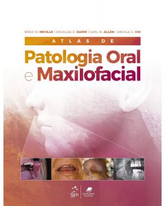 Atlas de Patologia Oral e Maxilofacial 
