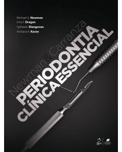 Newman e Carranza - Periodontia Clínica Essencial