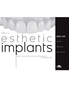 Esthetic Implants. How to think about complex cases in anterior areas with a global approach to the patient smile (2 books)