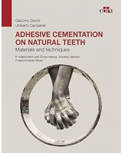 Adhesive cementation on natural teeth. Materials and techniques