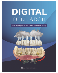 Digital Full Arch