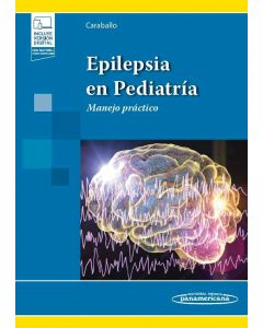 Epilepsia en Pediatría