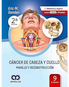 Cáncer de Cabeza y Cuello. Manejo y Reconstrucción 2 edicion