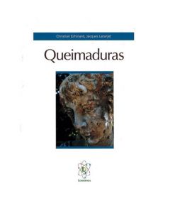 Queimaduras